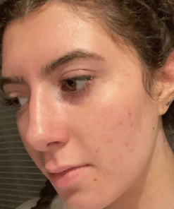 PanOxyl Acne Creamy Wash